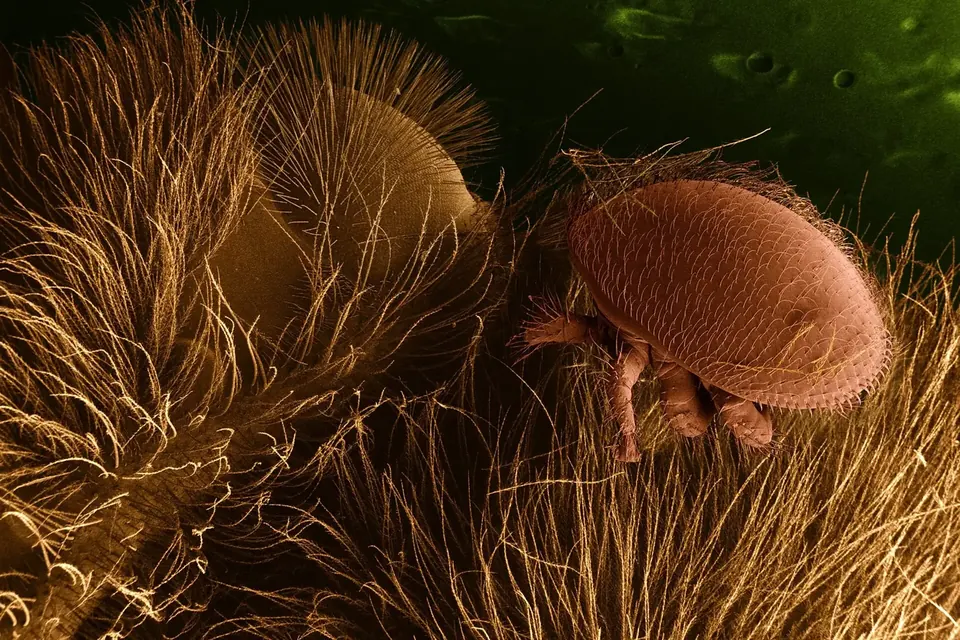 Image au microscope électronique, colorisée : un acarien varroa ovale et brun-rouge accroché entre les poils d'une abeille